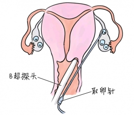 幼儿学画画，成都捐卵宝宝学画画，学画画的好处，如何学画画
