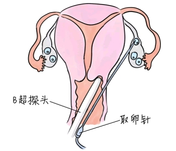 幼儿学画画，成都捐卵宝宝学画画，学画画的好处，如何学画画